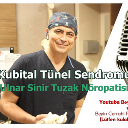 Podcast thumbnail for Kubital Tünel Sendromu (Ulnar sinir tuzak nöropatisi) Prof. Dr. Duran Berker Cemil