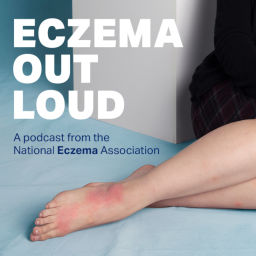 Podcast thumbnail for Eczema Out Loud
